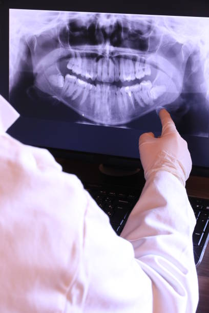 Best Emergency Root Canal Treatment in Pacifi, CA